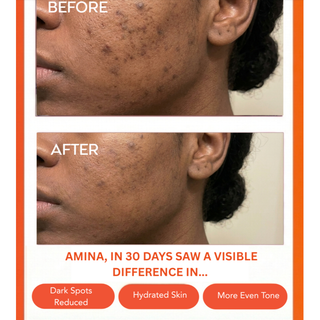 Clear Confidence Moisturizer 1.7 oz.