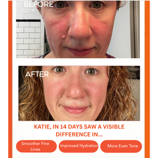 Hydrating Dew Moisturizer 1.7 oz.