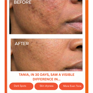 Hydrating Dew Moisturizer 1.7 oz.