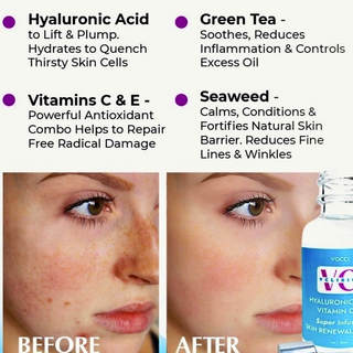 VCLINICA Hyaluronic Acid + Vitamins C & E Antioxidant Firming Serum