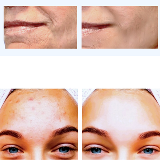 VCLINICA Hyaluronic Acid + Vitamins C & E Antioxidant Firming Serum