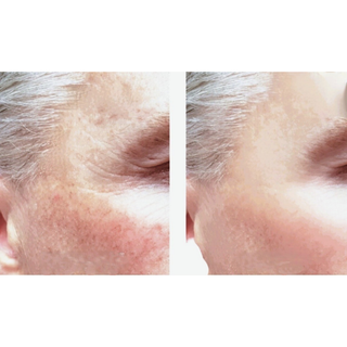 VCLINICA Hyaluronic Acid + Vitamins C & E Antioxidant Firming Serum
