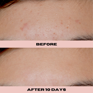 10% Glycolic Exfoliating Treatment Tonic