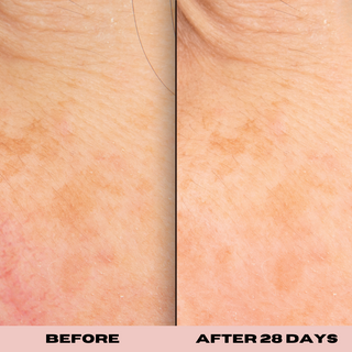 10% Glycolic Exfoliating Treatment Tonic