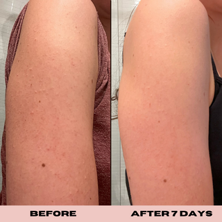 10% Glycolic Exfoliating Treatment Tonic