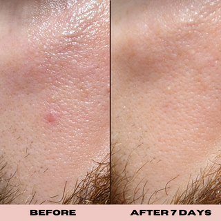 10% Glycolic Exfoliating Treatment Tonic
