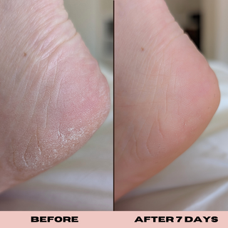 10% Glycolic Exfoliating Treatment Tonic