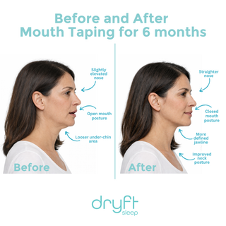 Mouth Tape (30-pack)