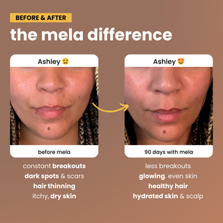 Daily Glow Vitamins For Glowing Skin & Healthy Hair 30 servings