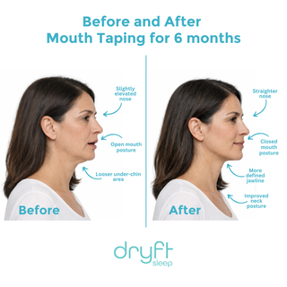 Mouth Tape (30-pack)