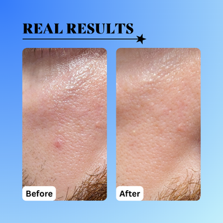 10% Glycolic Exfoliating Treatment Tonic 6 oz.