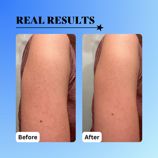 10% Glycolic Exfoliating Treatment Tonic 6 oz.