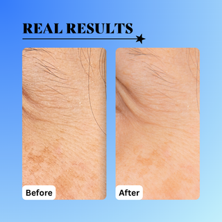 10% Glycolic Exfoliating Treatment Tonic 6 oz.