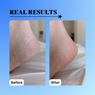 10% Glycolic Exfoliating Treatment Tonic 6 oz.