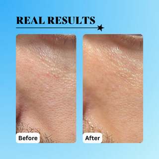 Radical Replenishment Serum 1 oz.