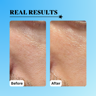 Radical Replenishment Serum 1 oz.